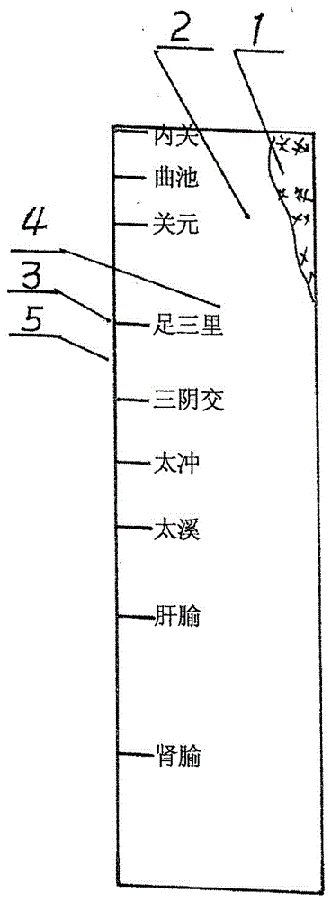 Moxa-moxibustion device for treating cerebral arteriosclerosis by moxibustion