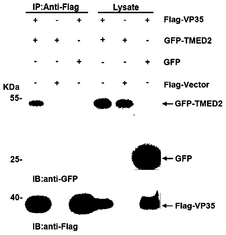 Application of TMED2 as treatment target spot of Ebola viral disease