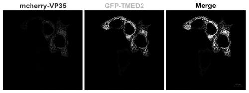 Application of TMED2 as treatment target spot of Ebola viral disease