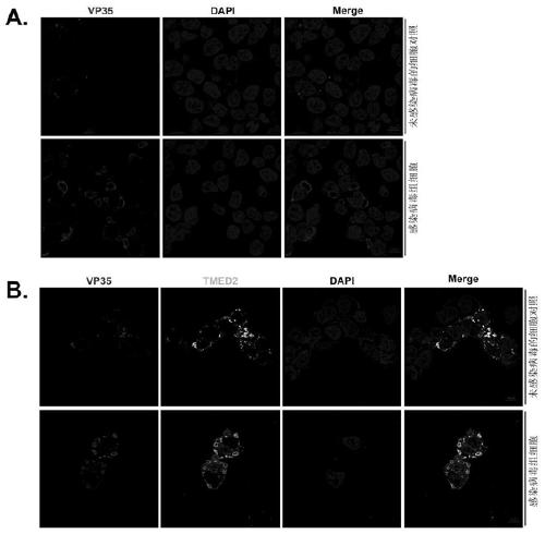 Application of TMED2 as treatment target spot of Ebola viral disease