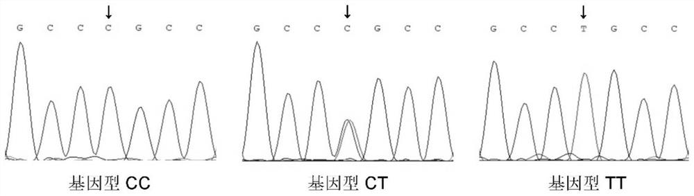 Mutation site associated with total litter size character of sow and application of mutation site