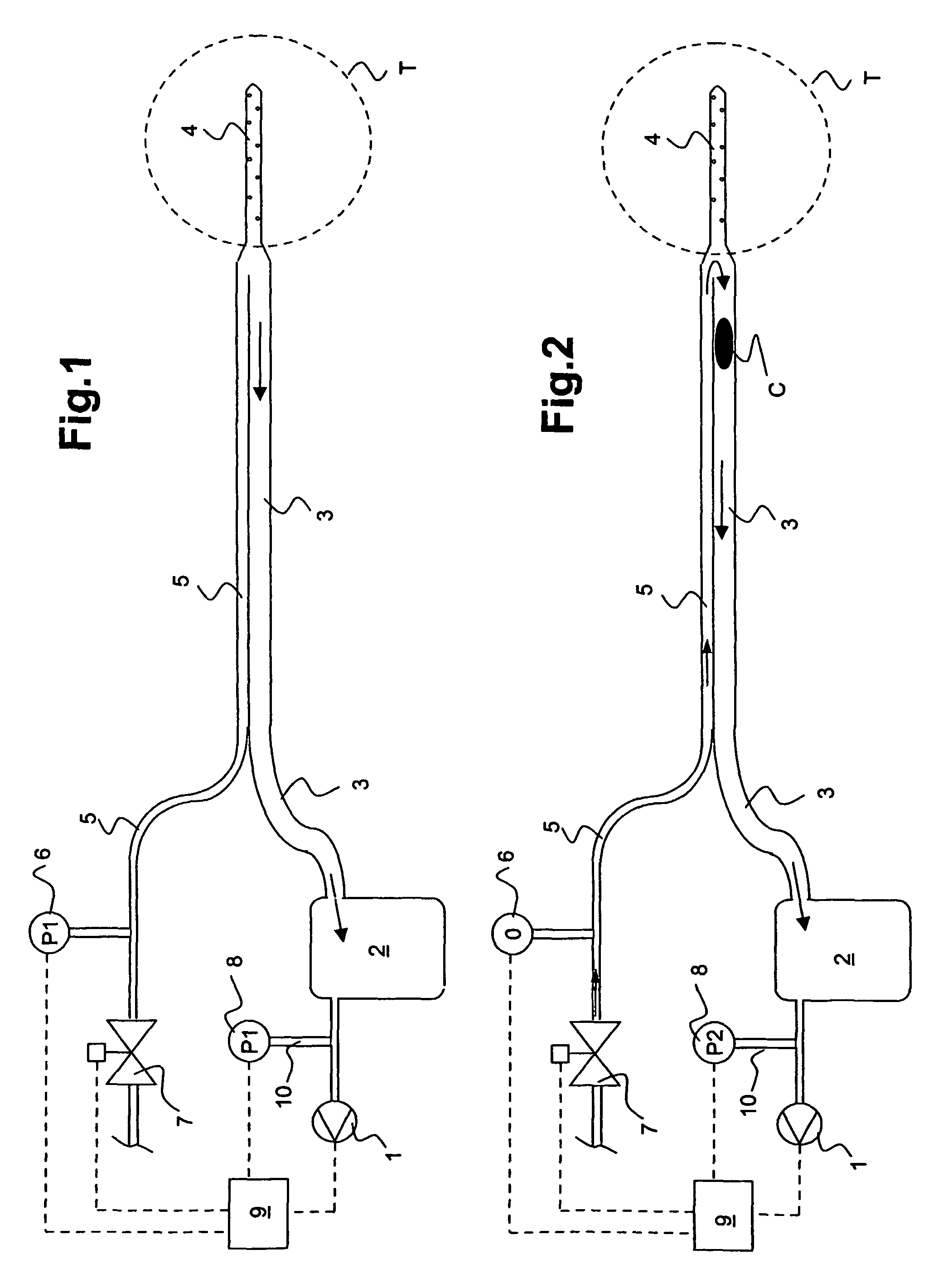 Drainage apparatus and method