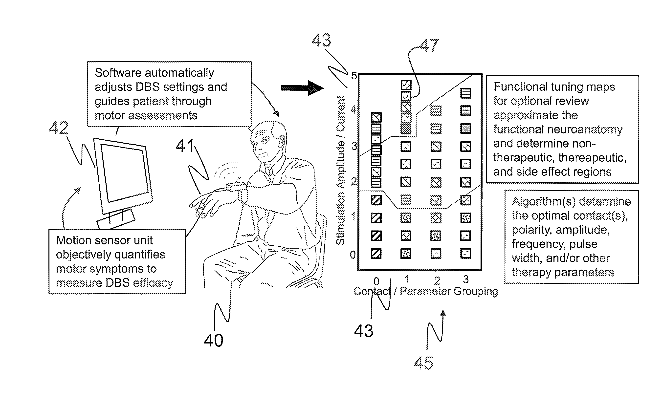 Movement disorder therapy system and methods of tuning remotely, intelligently and/or automatically