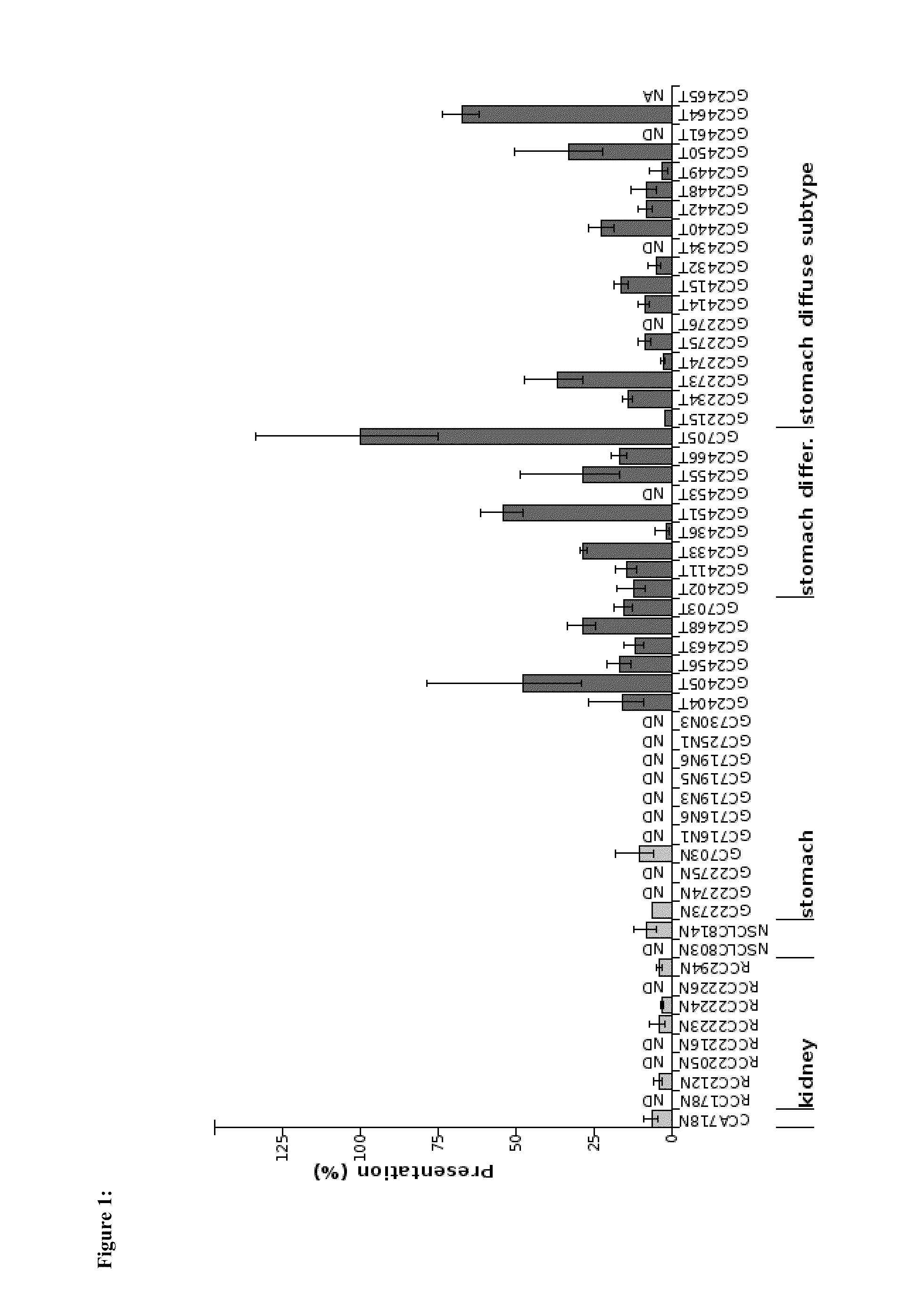 Methods for the diagnosis and treatment of cancer based on AVL9