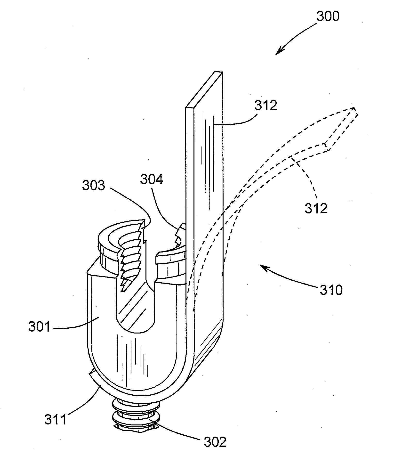 Pedicle screw including stationary and movable members for facilitating the surgical correction of spinal deformities