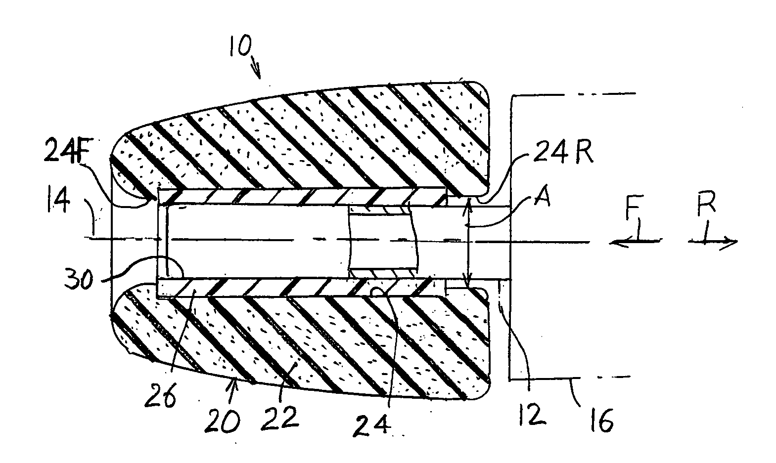 Earbud and method of manufacture