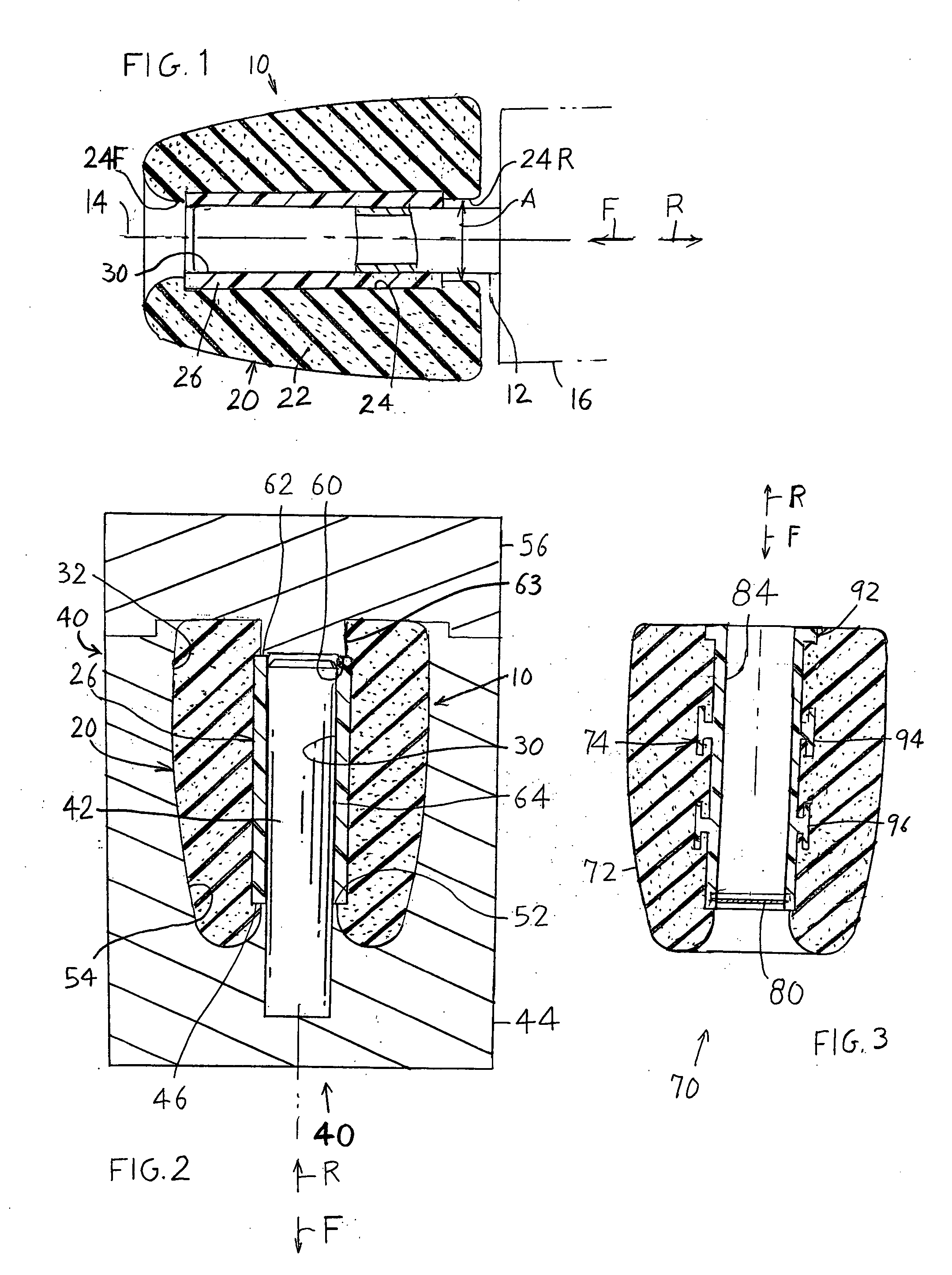Earbud and method of manufacture