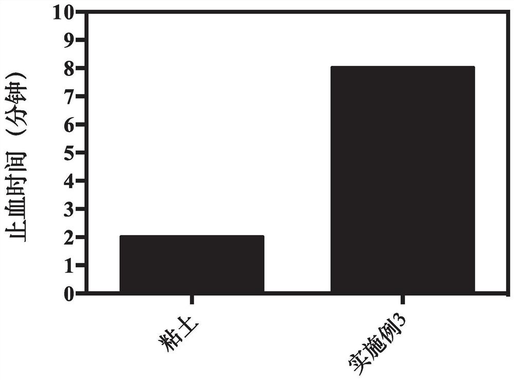 A kind of preparation method and application of injectable polysaccharide clay composite gel