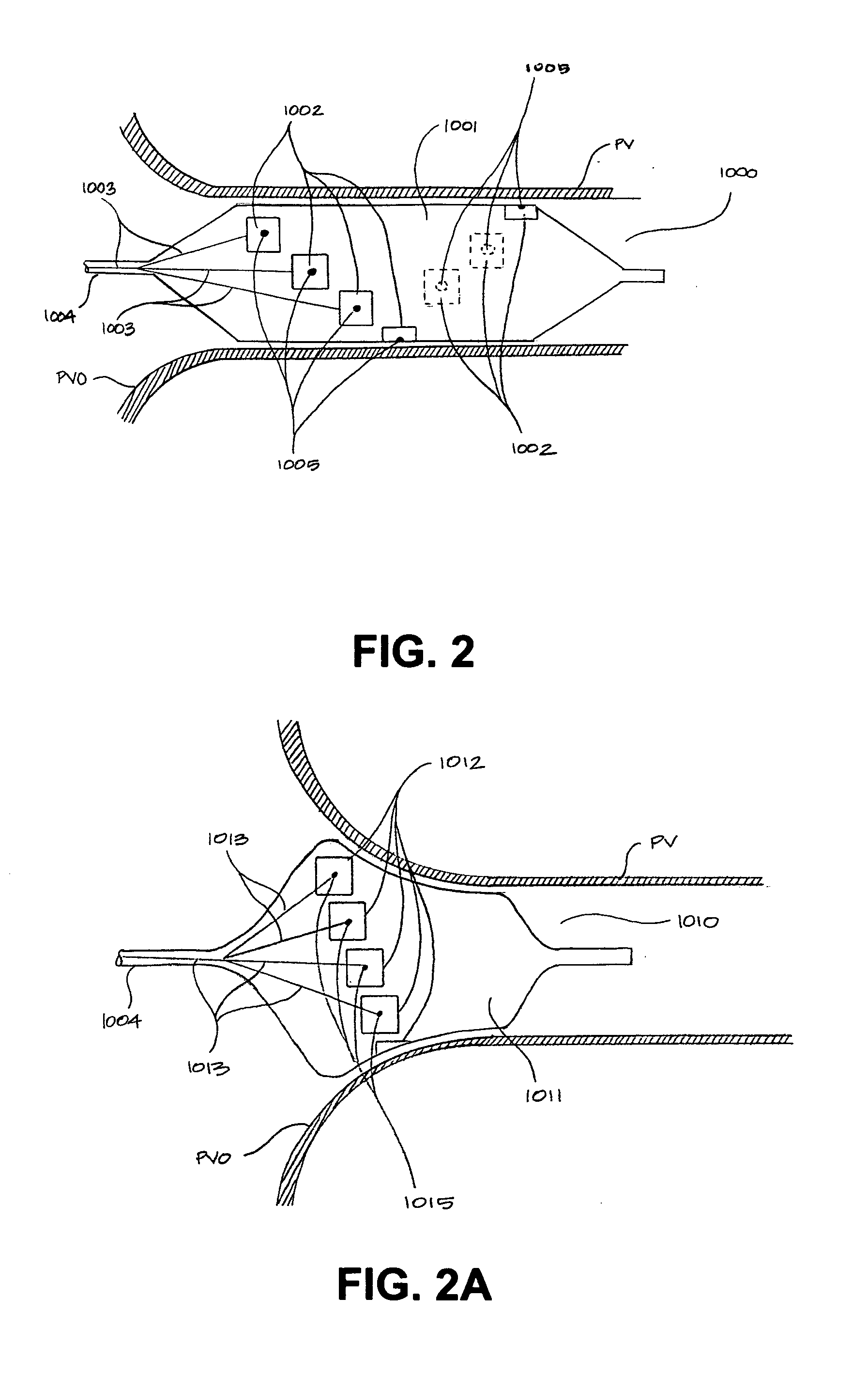 Devices and methods for denervation of the nerves surrounding the pulmonary veins for treatment of atrial fibrillation