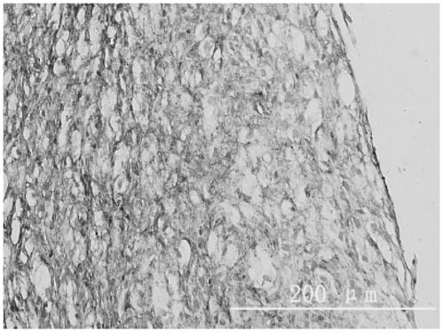 A preparation method of bacterial cellulose membrane tissue engineering artificial tendon scaffold