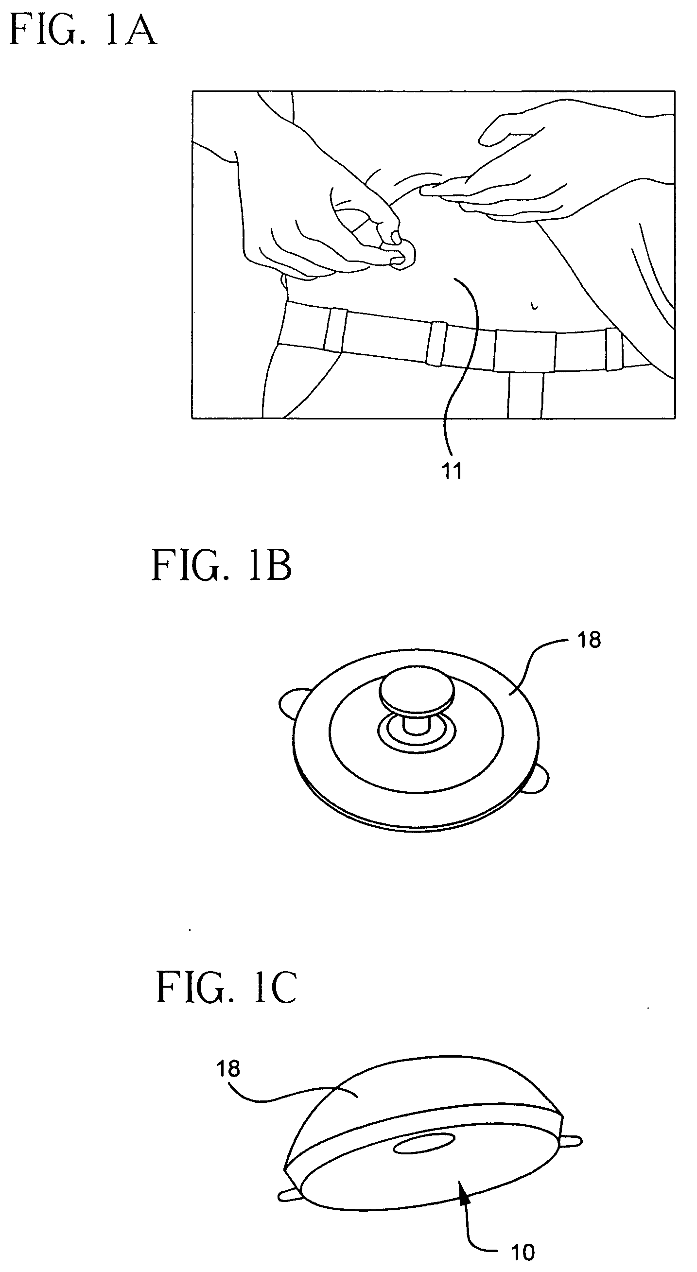 Method And Apparatus For Delivering A Therapeutic Substance Through An Injection Port