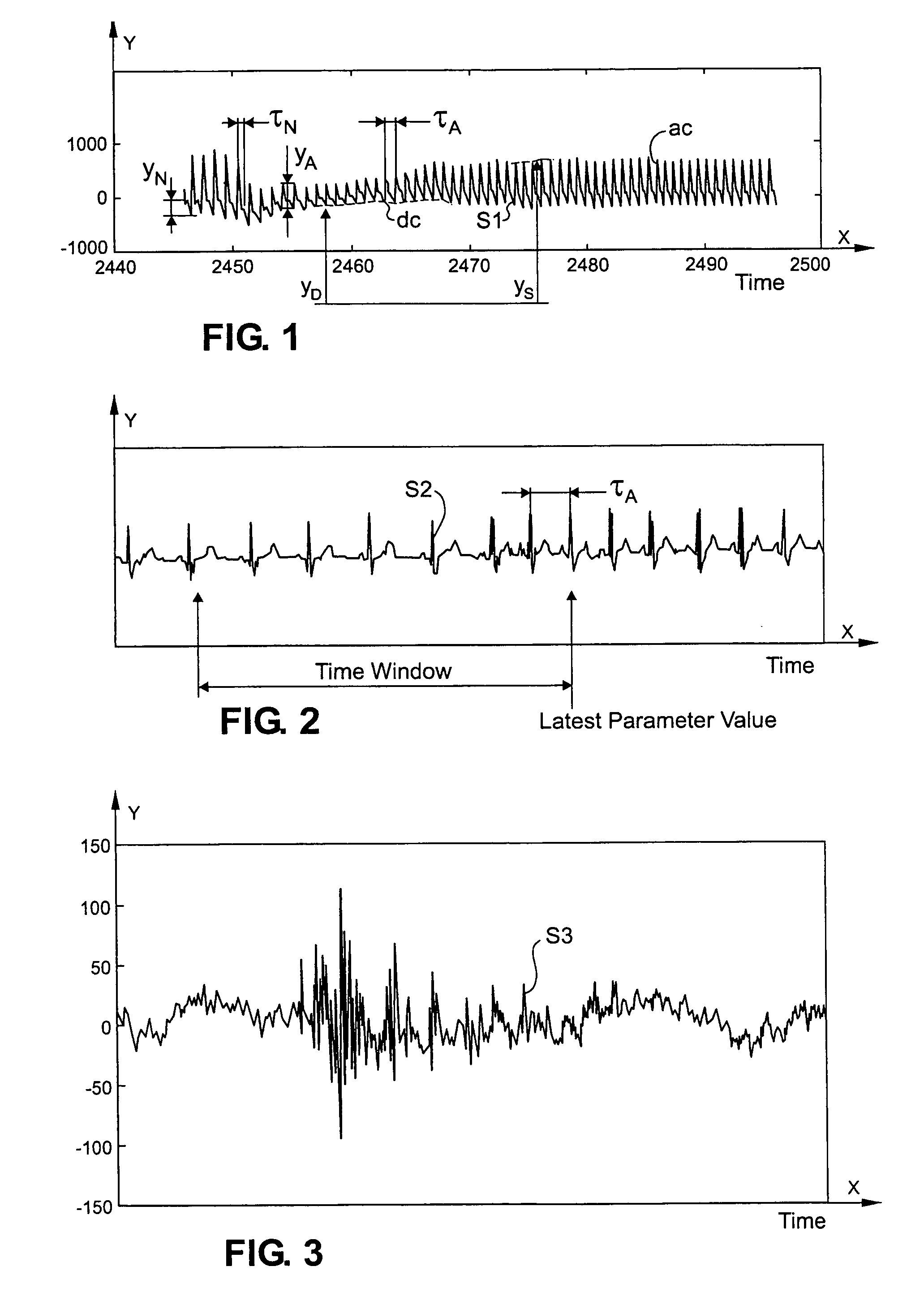Method and apparatus based on combination of physiological parameters for assessment of analgesia during anesthesia or sedation