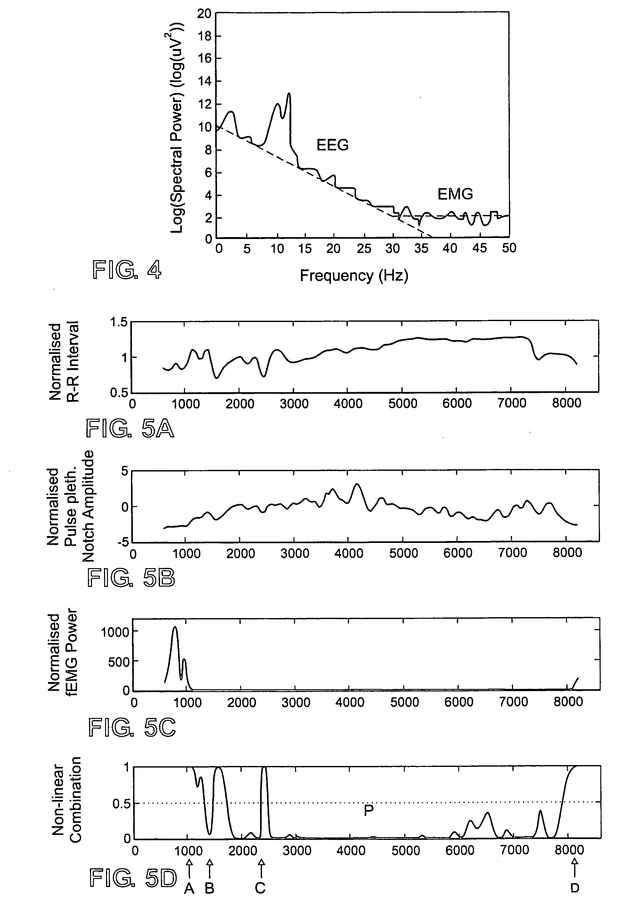 Method and apparatus based on combination of physiological parameters for assessment of analgesia during anesthesia or sedation