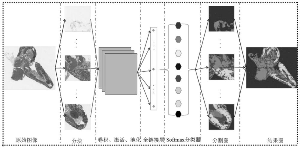 Tissue segmentation method for colorectal panoramic digital pathology images based on deep network