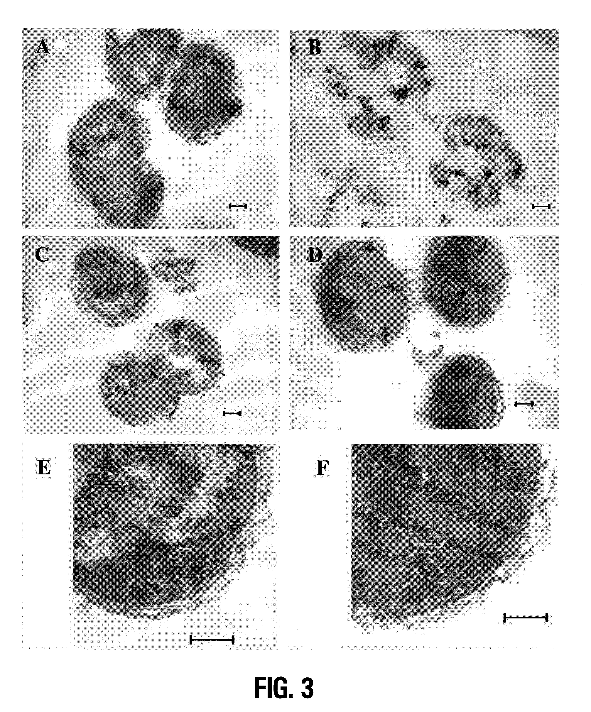 Lipid a deficient mutants of <i>Neisseria meningitidis </i>