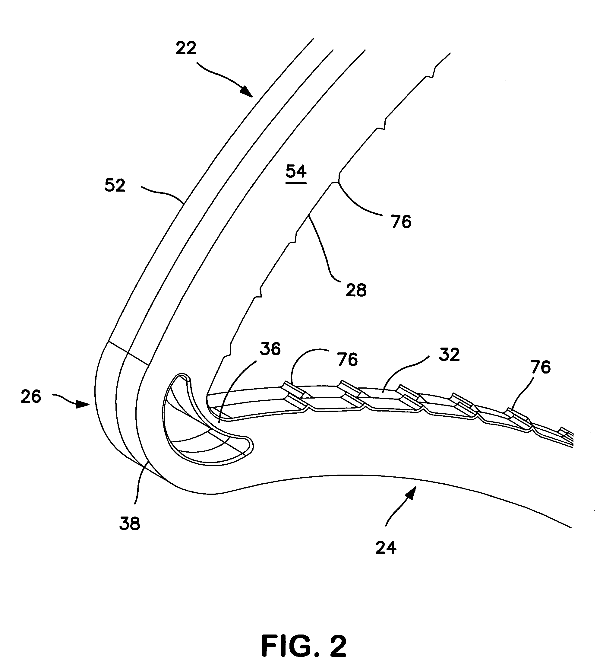 Ligating clip with integral interlocking latch mechanism