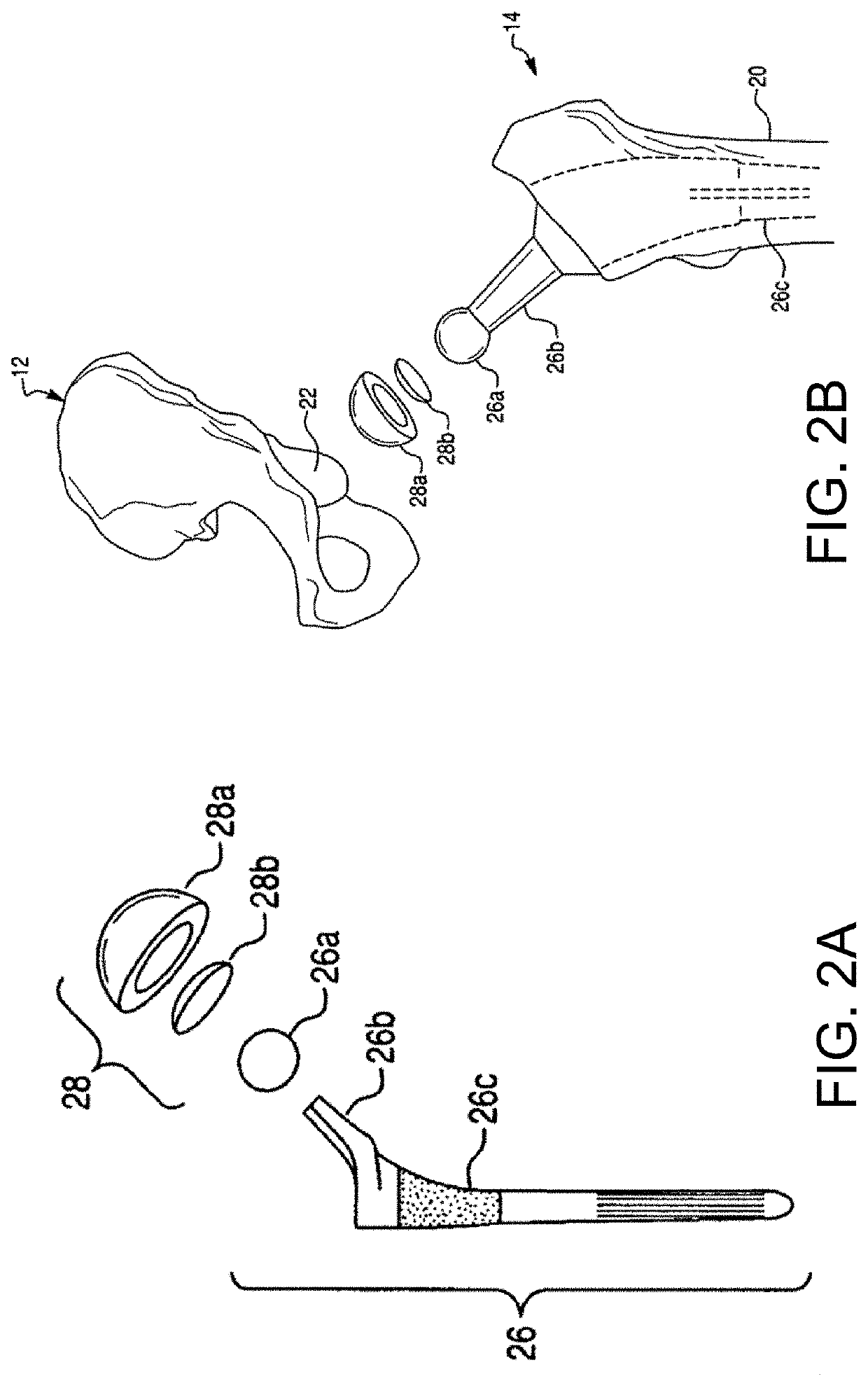 Systems and methods for intra-operative pelvic registration