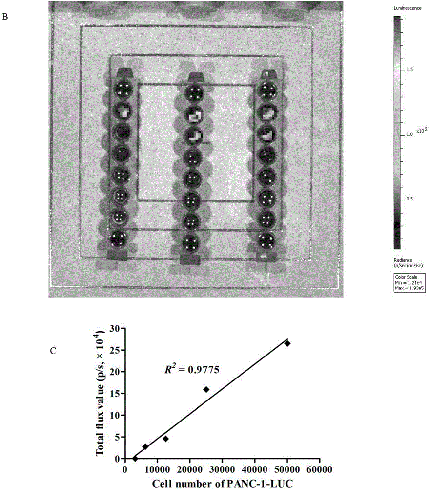 Human pancreatic cancer nude mouse model construction method and use thereof