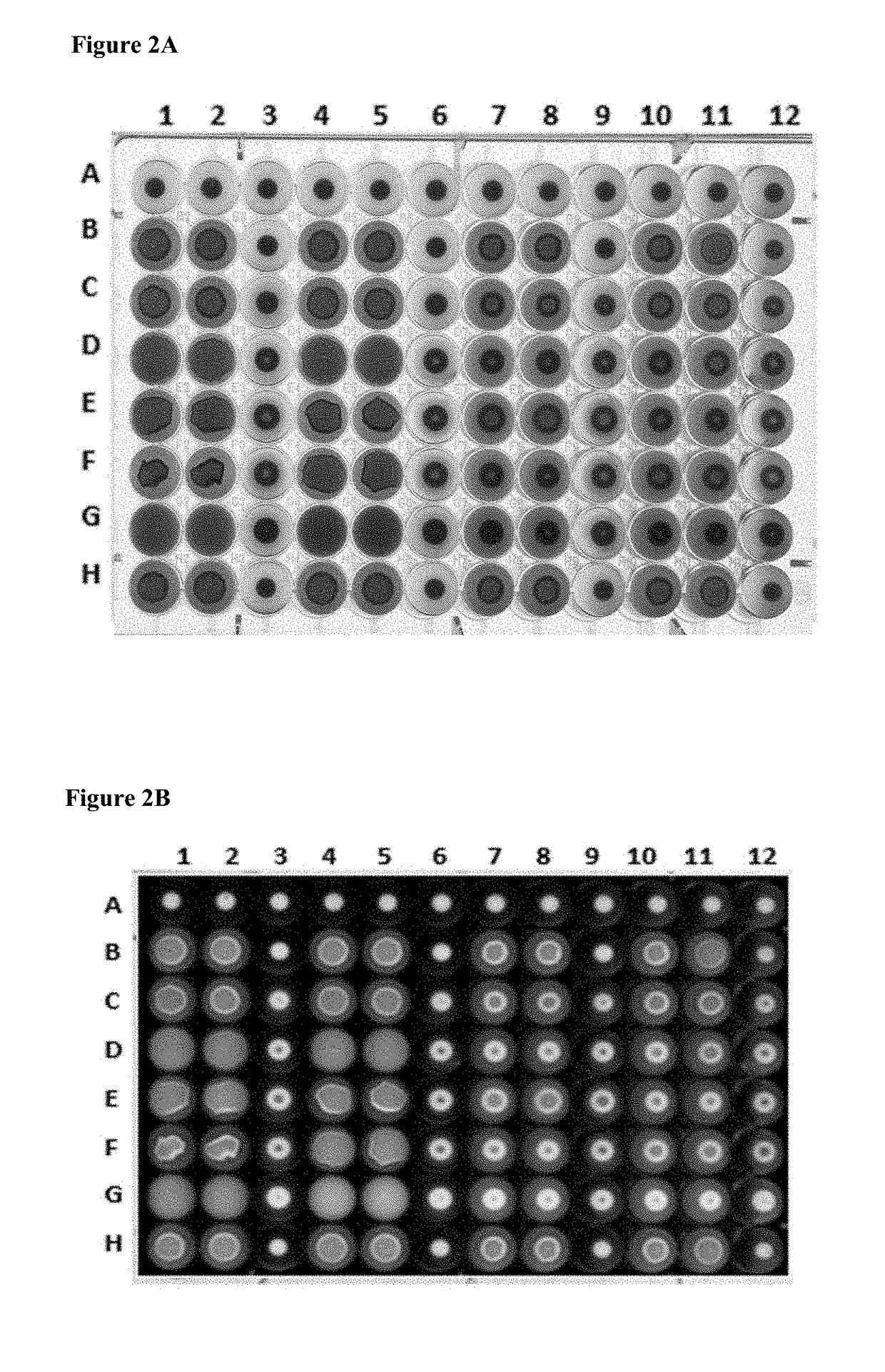 Compositions and methods for treating and/or preventing a urinary tract infection