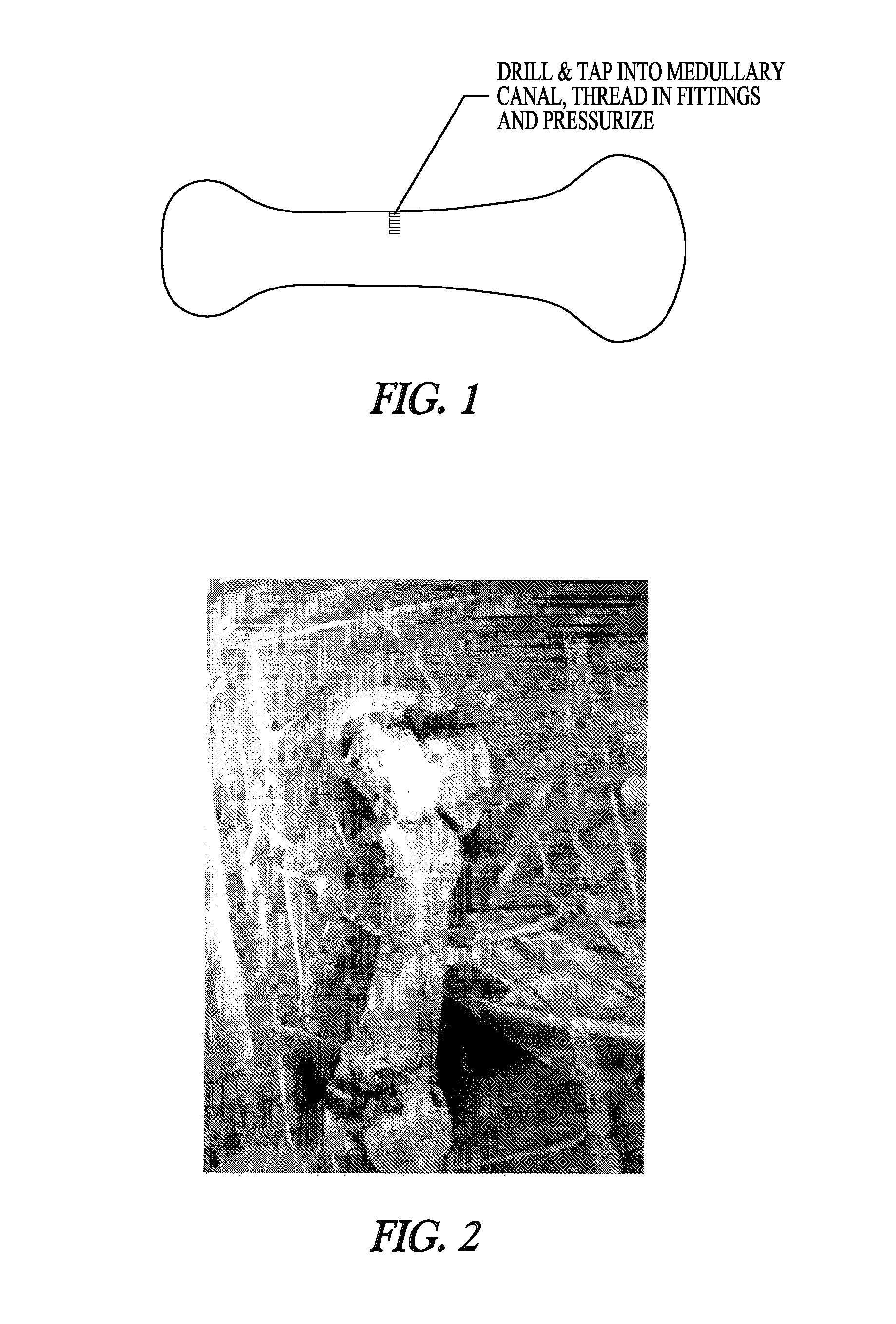 Methods of decellularizing bone