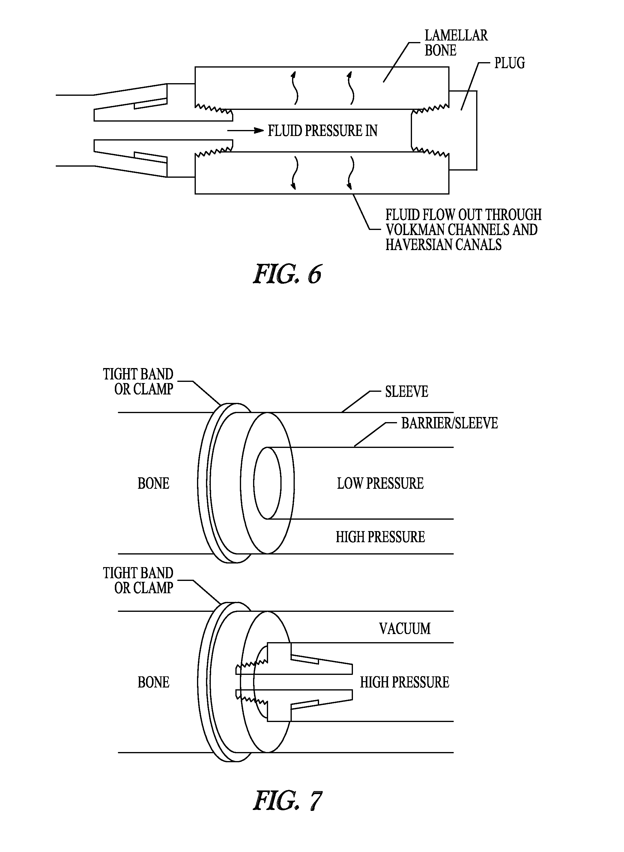 Methods of decellularizing bone