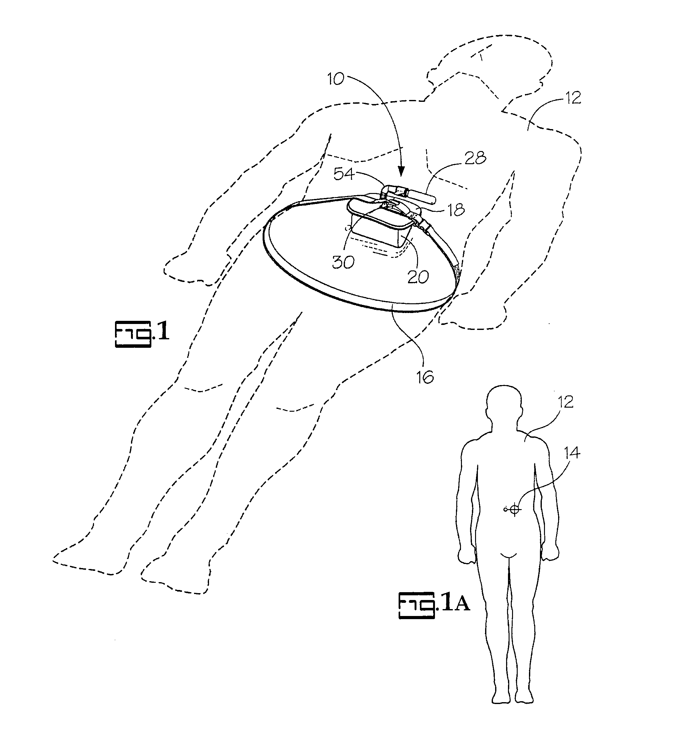 Portable pneumatic abdominal aortic compression system