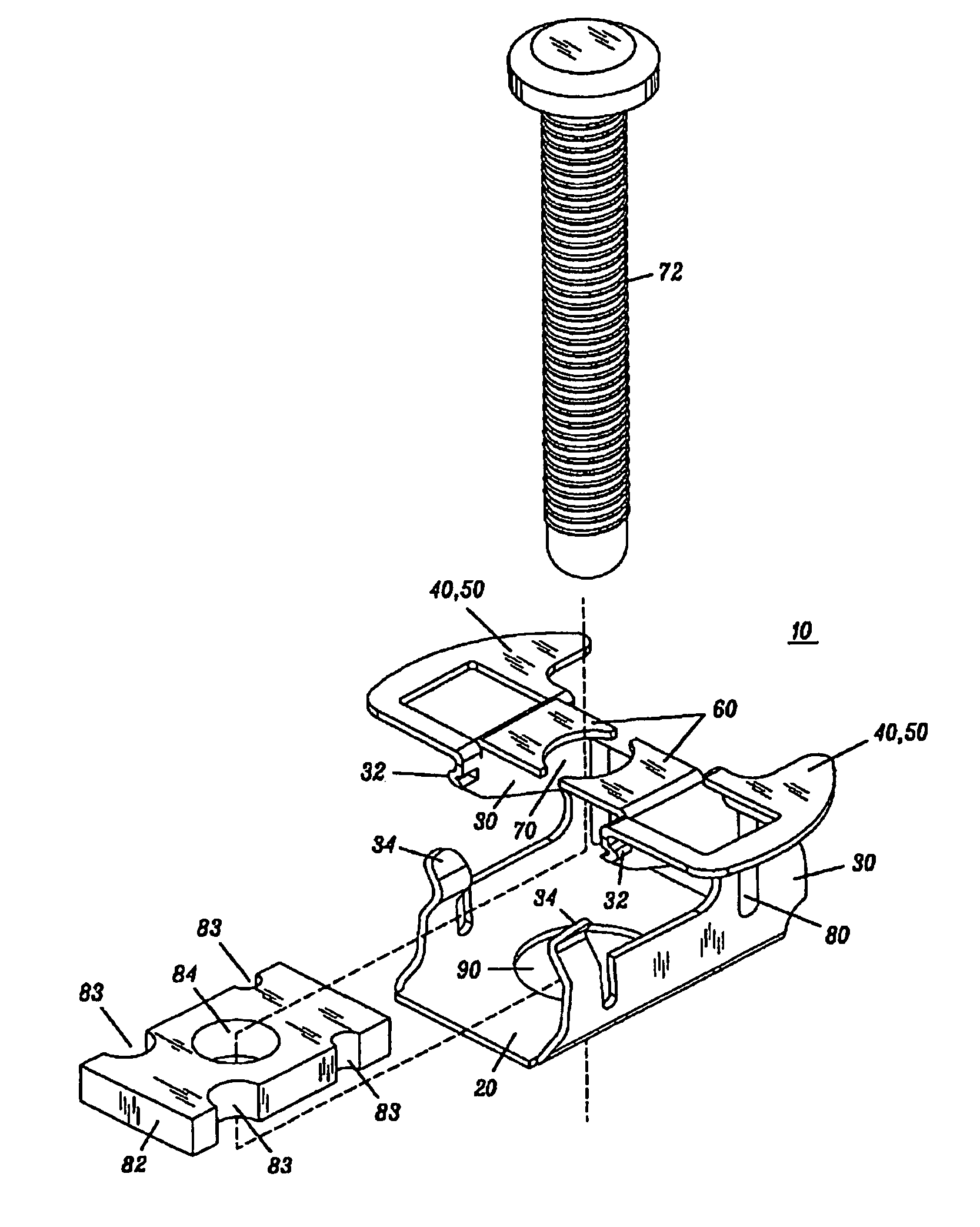 Removable anchor and fastener