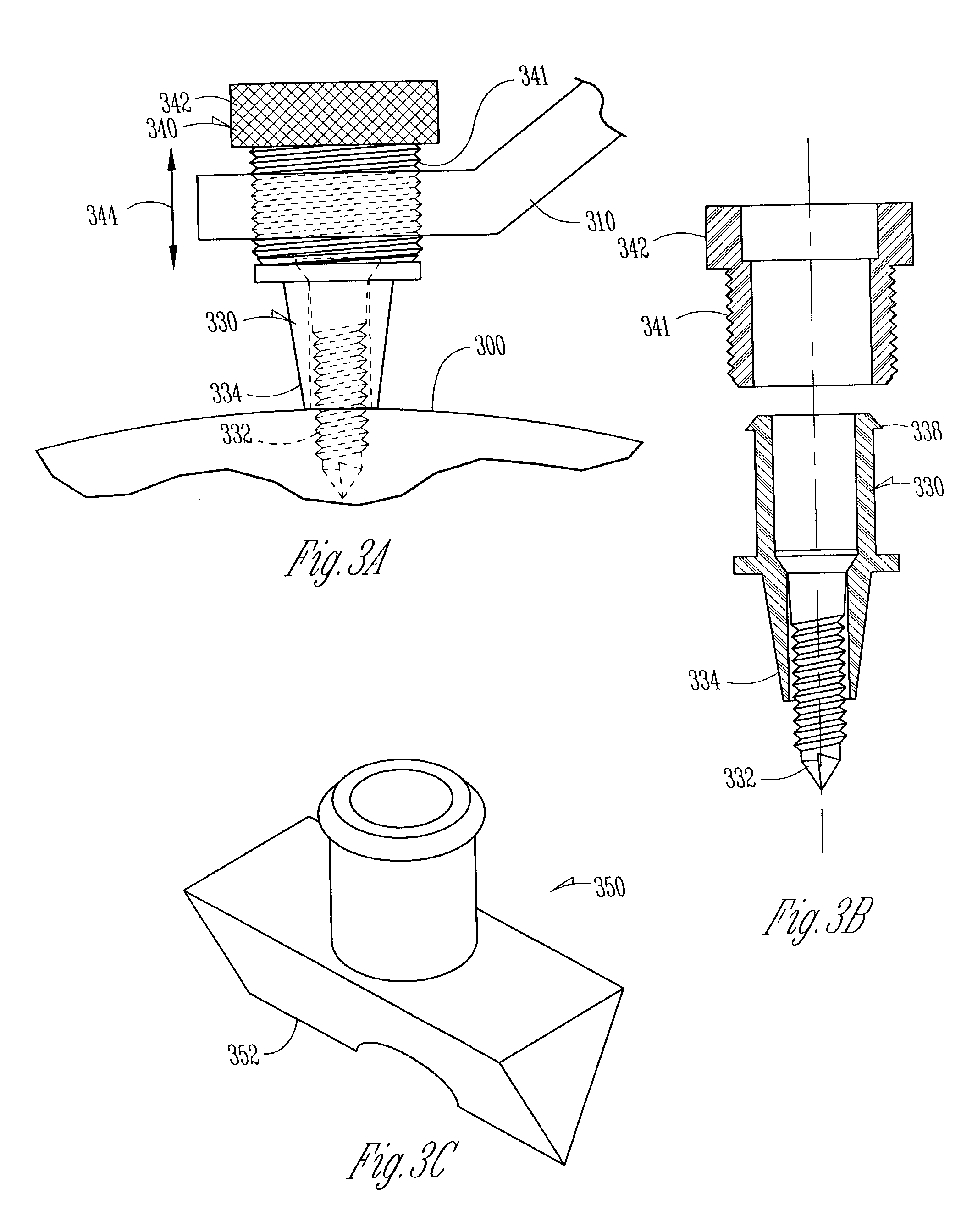Organ access device and method