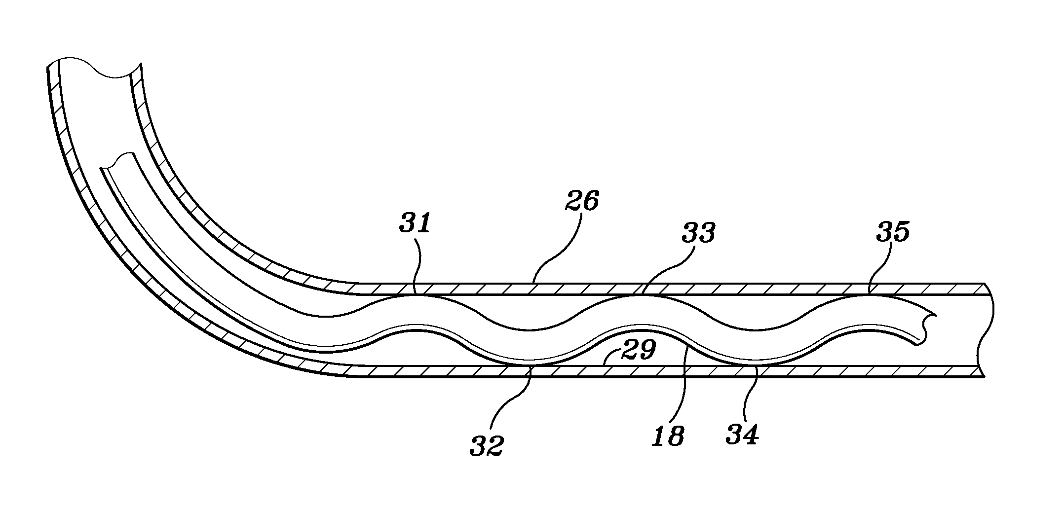 Method of Reducing Corrosion on Metal Surfaces