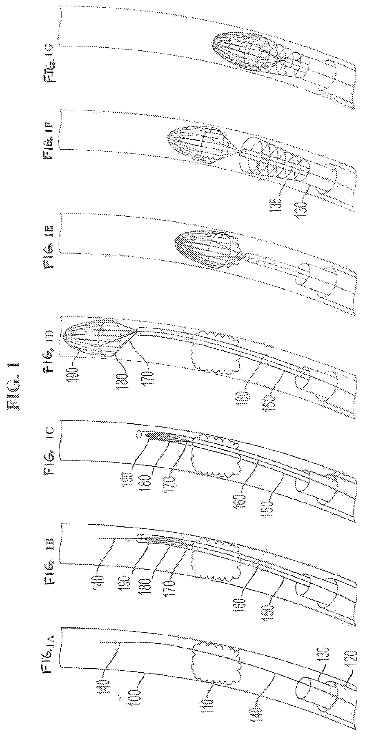 Device and method for treatment of deep vein   thrombosis and pulmonary embolism