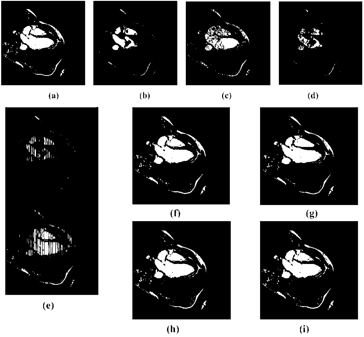 Non-rigid heart image grading and registering method based on optical flow field model