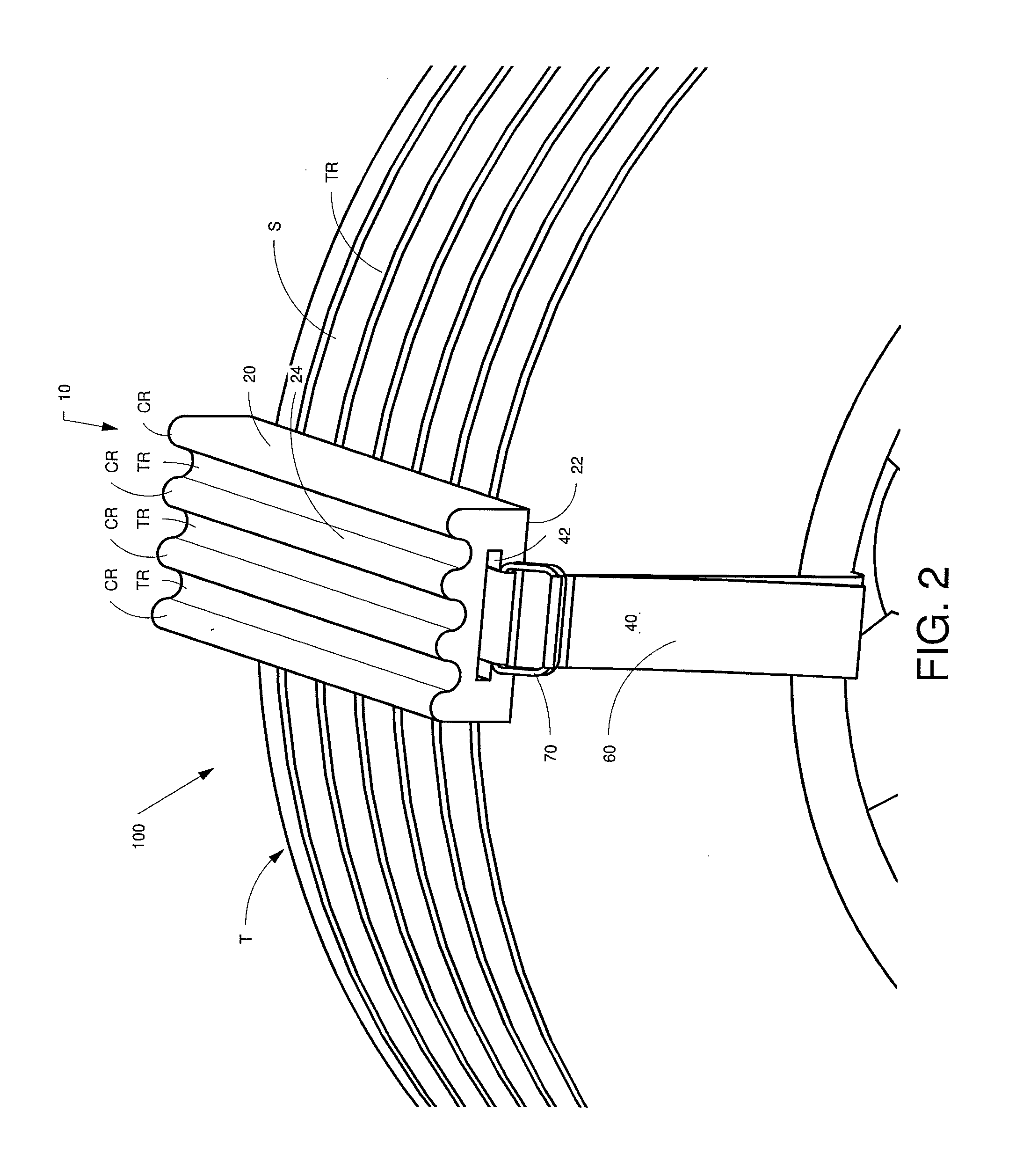 Vehicle wheel lifting block apparatus for climbing out of depression in viscous surfaces