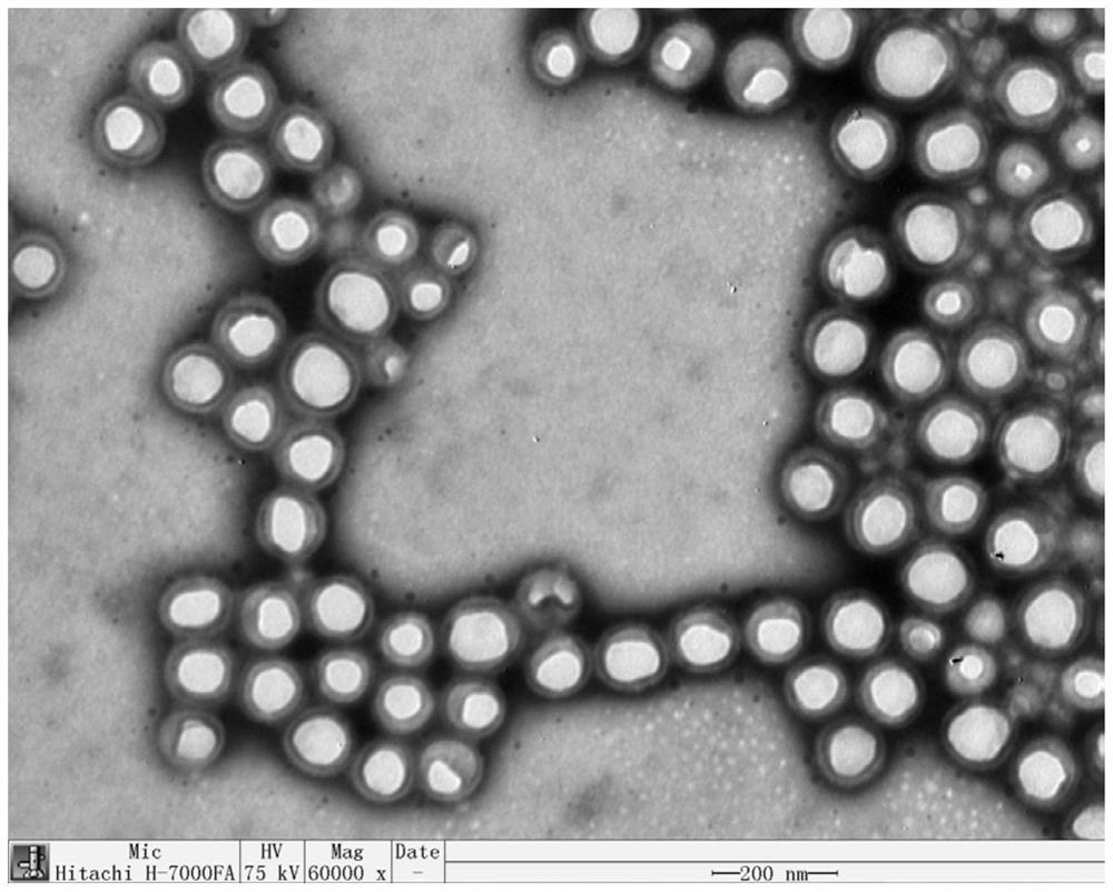 Application of polymer nanoprobe based on perflubron