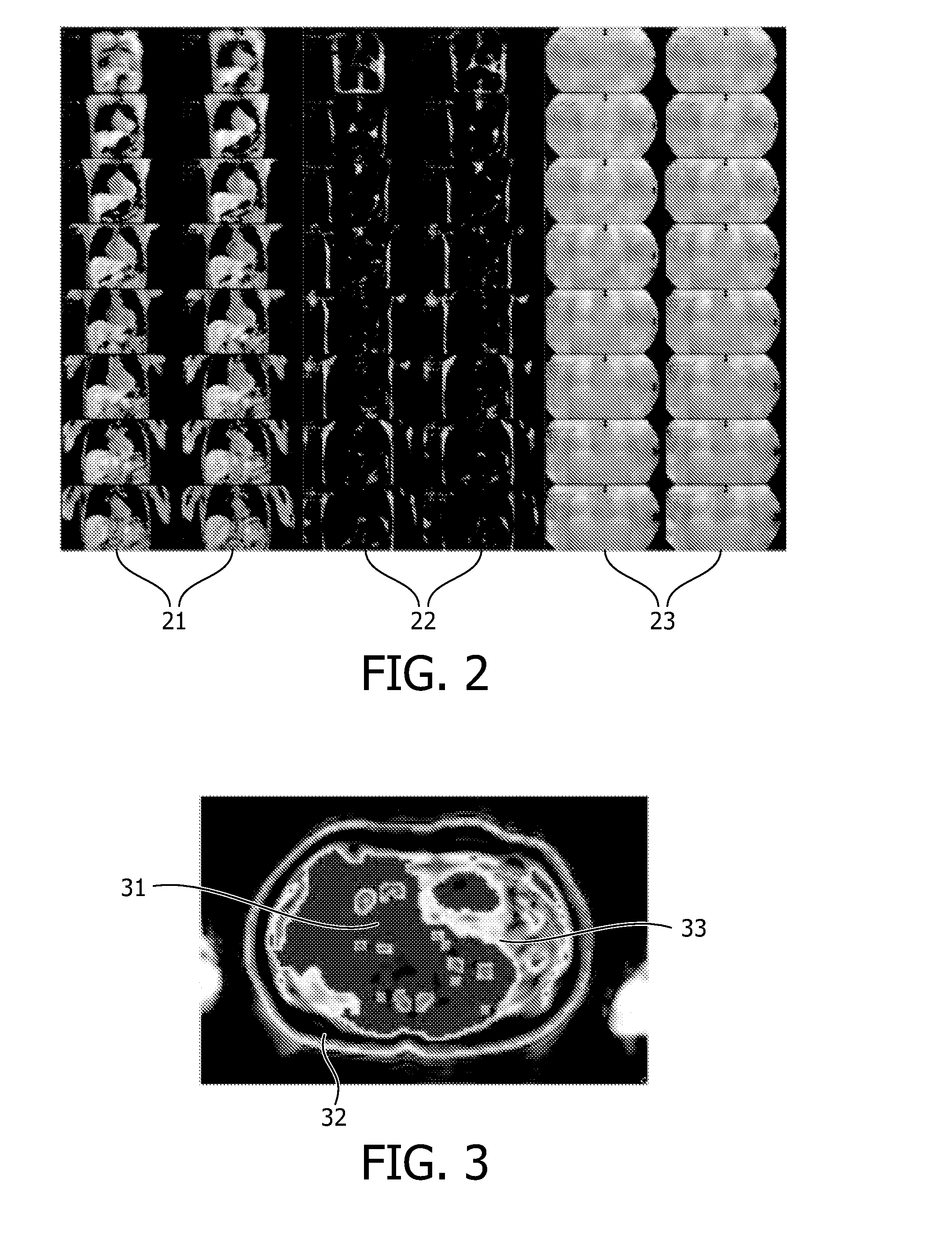 Mr imaging using a multi-point dixon technique