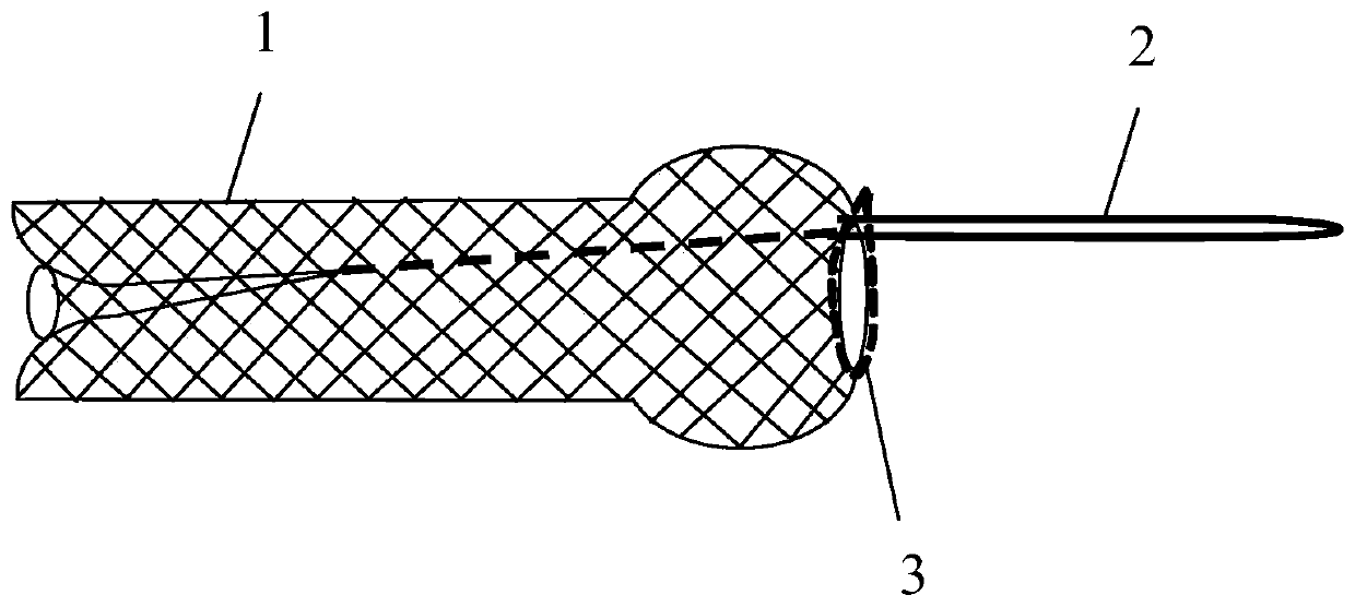 Full-film-coated self-expanding recyclable biliary tract metal stent