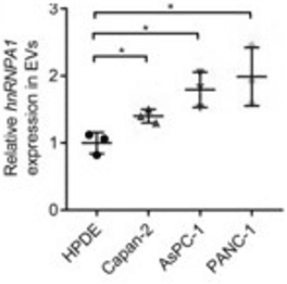 Application of hnRNPA1 in diagnosis, prognosis and treatment of pancreatic cancer