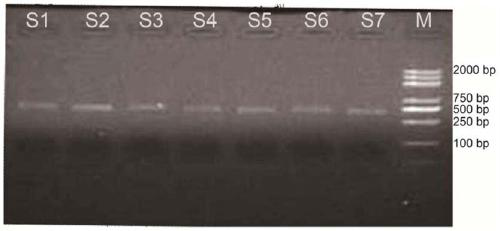 PCR primers and method for detecting composition of environmental microorganism arsenic oxidation gene species