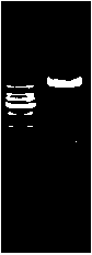 Lovastatin acylase containing one or several point mutations