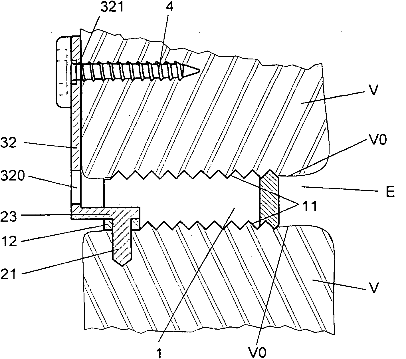 Vertebral cage device with modular fixation