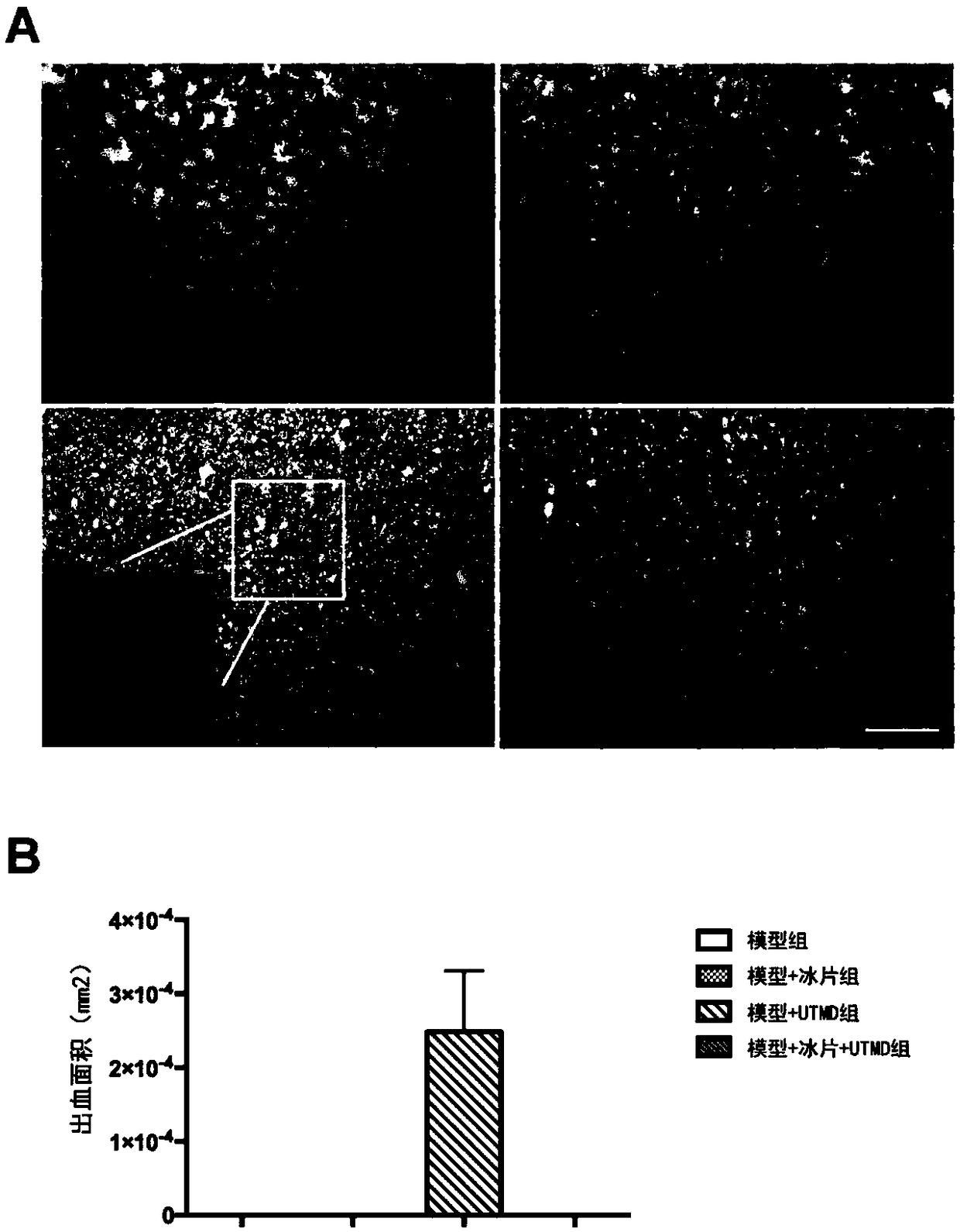 Application of borneol as active ingredient of drug for relieving ultrasound targeted microbubble destruction induced focal cerebral ischemia blood-brain barrier opening