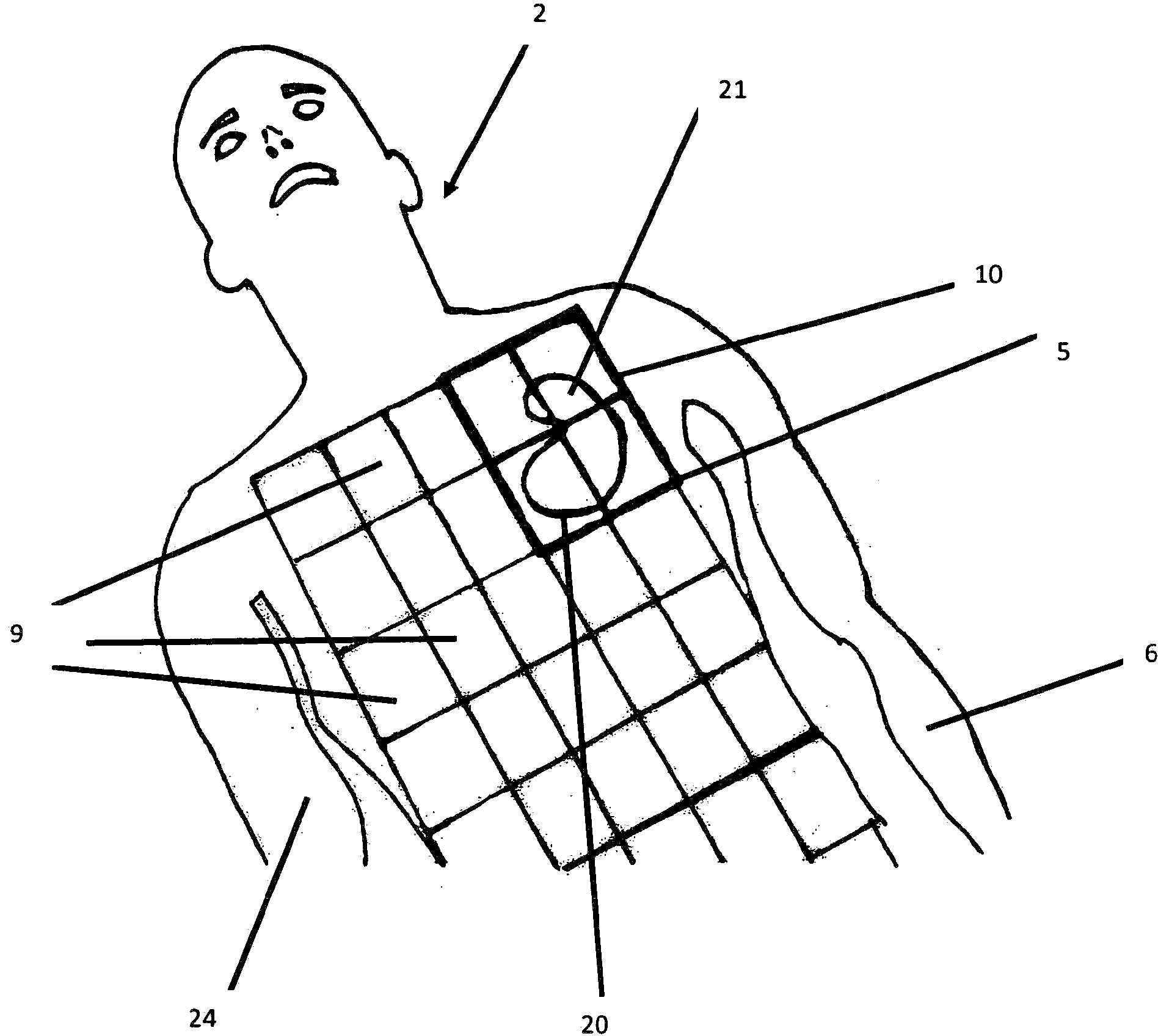 Method and apparatus for irradiating irregularly shaped areas