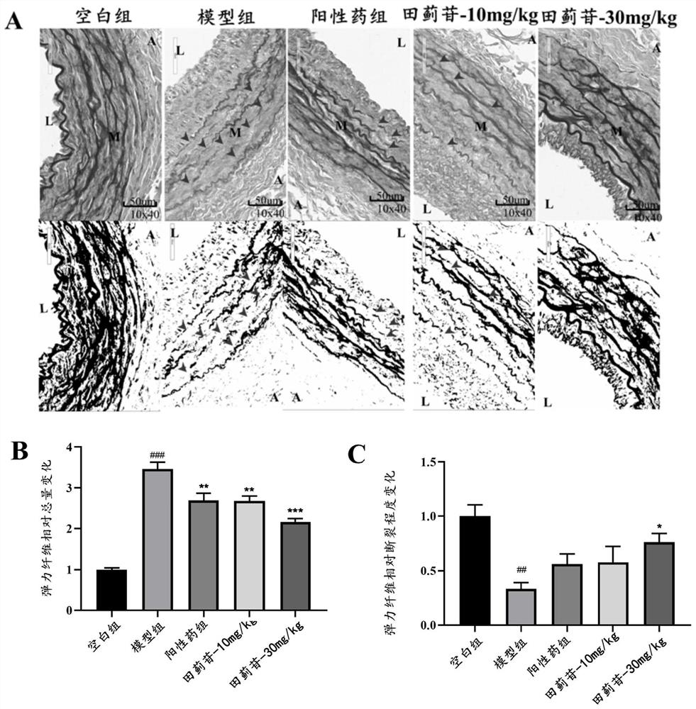 Application of tilianin in preventive protection medicine for abdominal aortic aneurysm