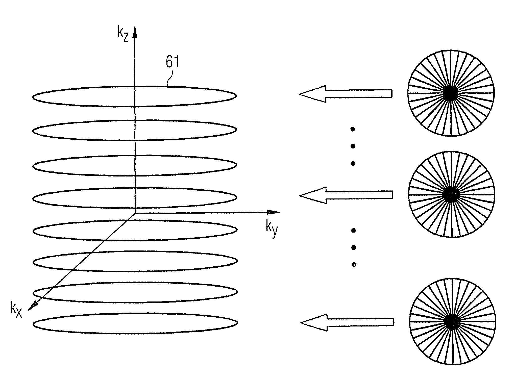 MR-angiography with non-cartesian signal acquisition