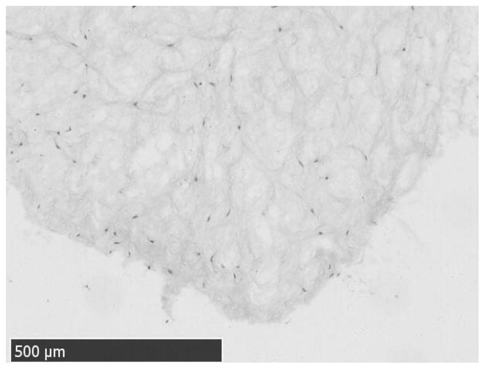 Preparation and cryopreservation method and application of human placental villous tissue