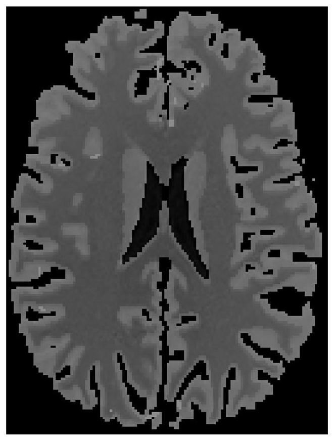 Low-dose cerebral perfusion CT reconstruction method based on prior image constraint diffusion tensor