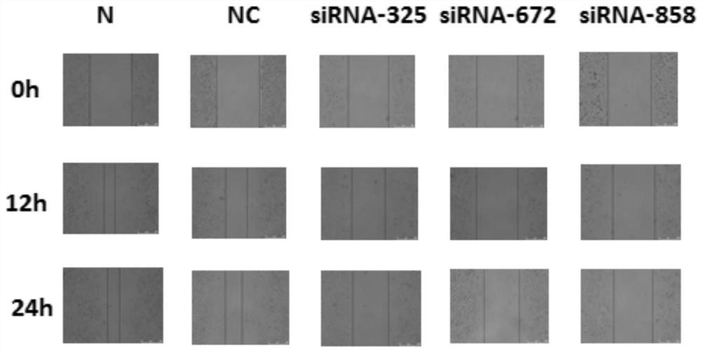 Application of substance for knocking down BACE2 gene expression in tumor resistance and BACE2 inhibitor