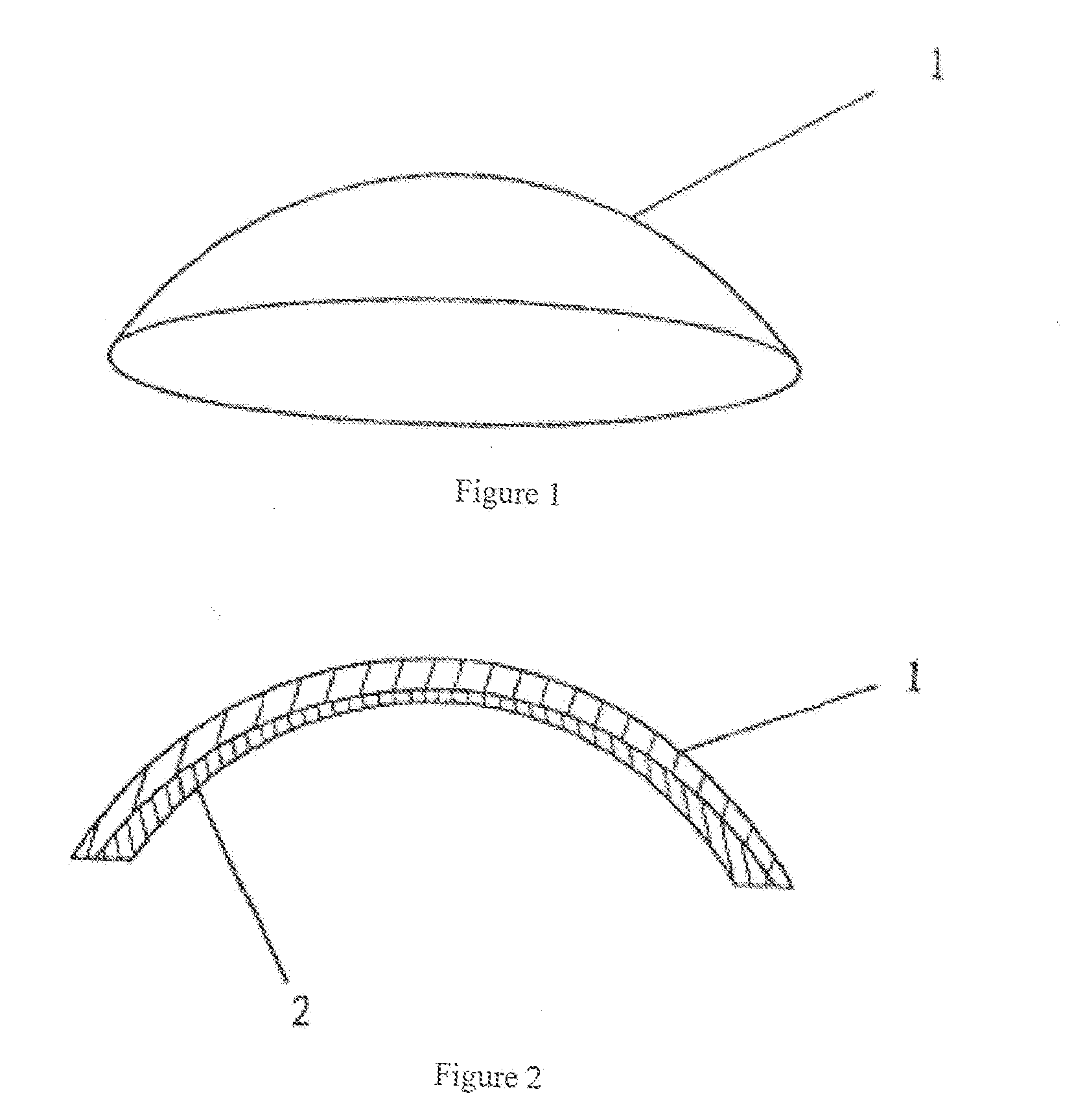 Biological artificial cornea and method of making