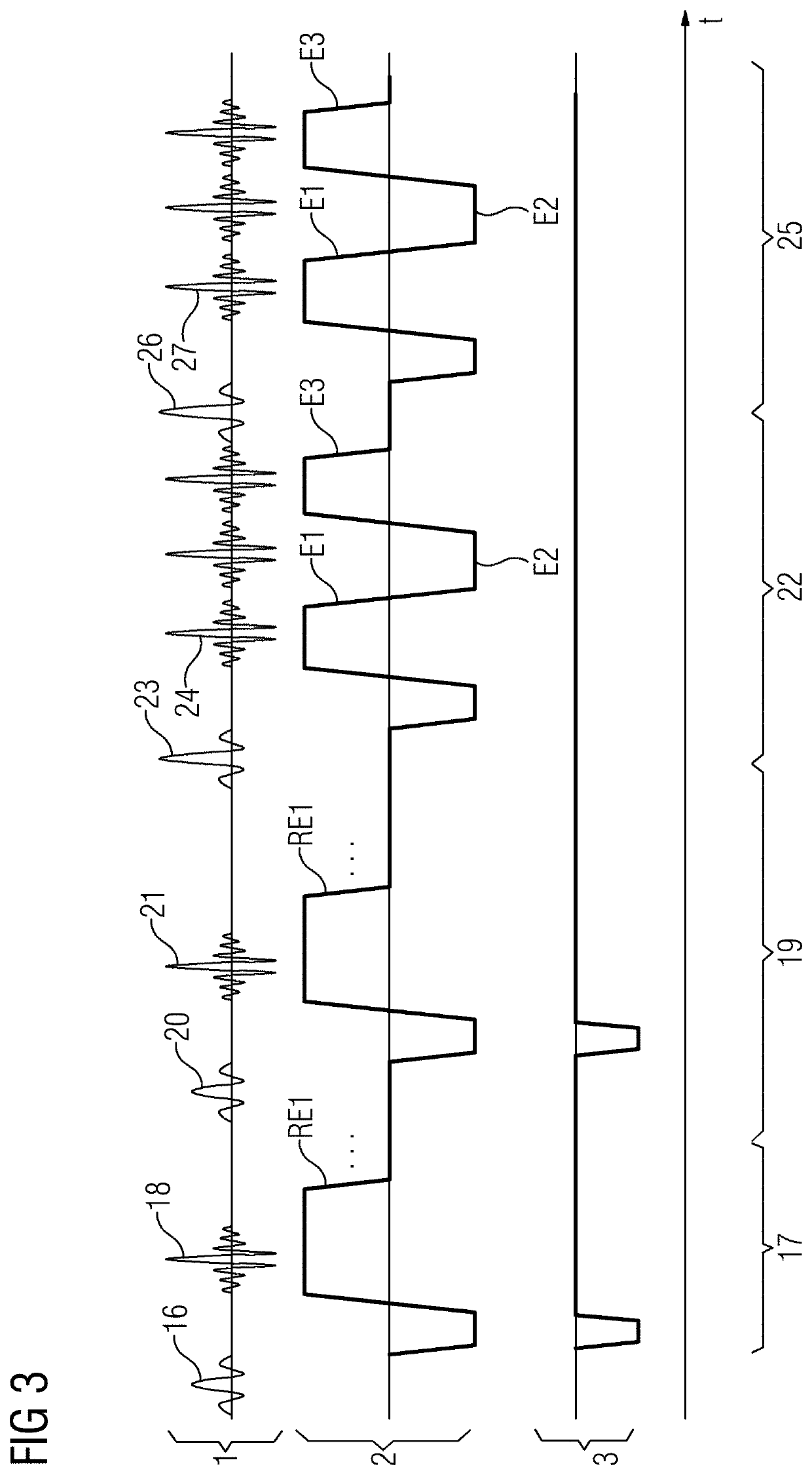 Method and system for creating magnetic resonance images