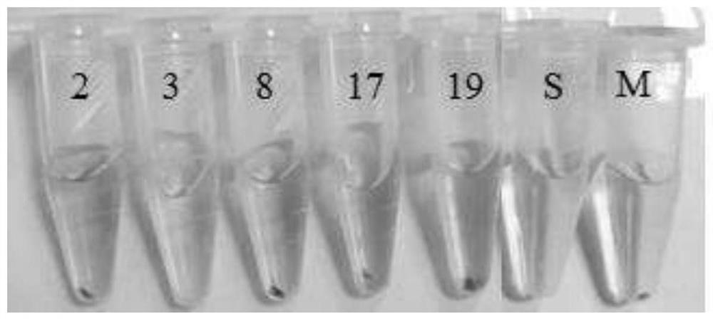 Marine Streptomyces s063 and its anti-complement activity application