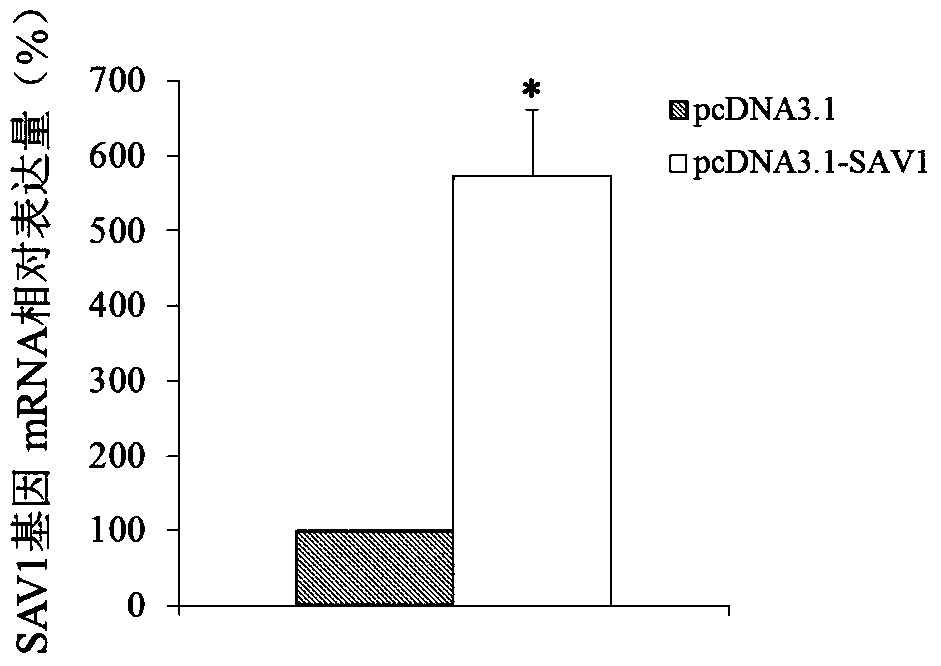 Use of sav1 gene as a marker for diagnosis and treatment of uterine fibroids